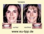 Zahn-Reise nach CZ - Euro 179 all inclusive - Implantate Euro 490